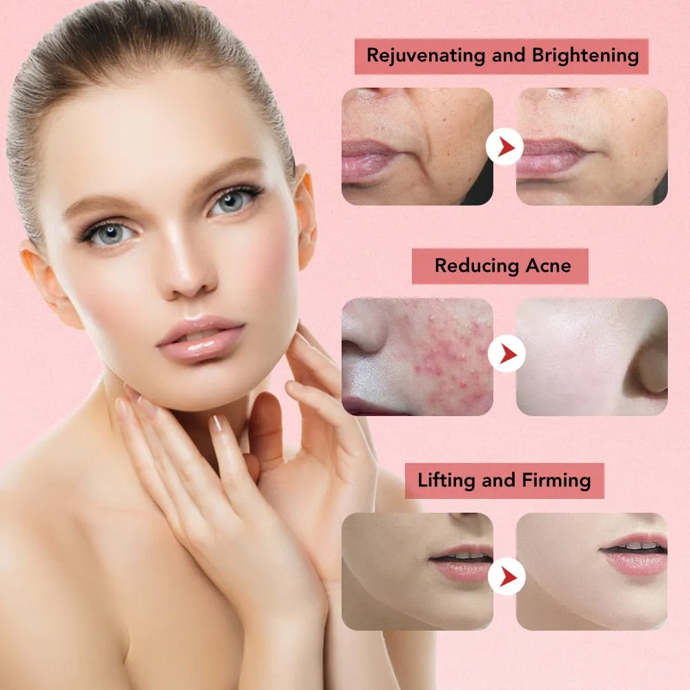 7in1 RF&amp;EMS Face Massager Lifting Beauty LED Face Skin  3 Colors LED Facial Neck Massager Photon Therapy Heating Wrinkle Removal