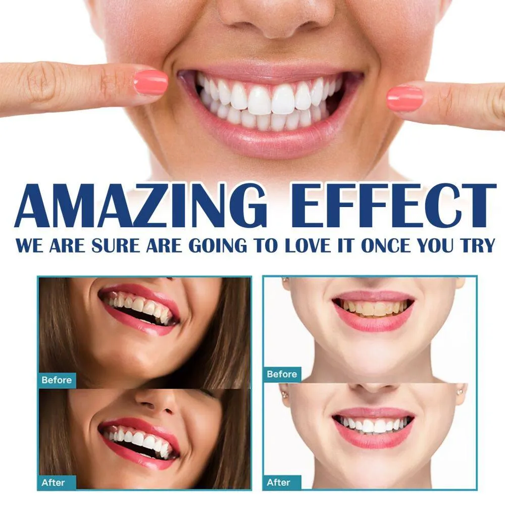 ayuting Teeth Whitening Paint Remove Plaque Stain Yellow Teeth Stain Sensitive Mouth Breath  Oral Care 5ml