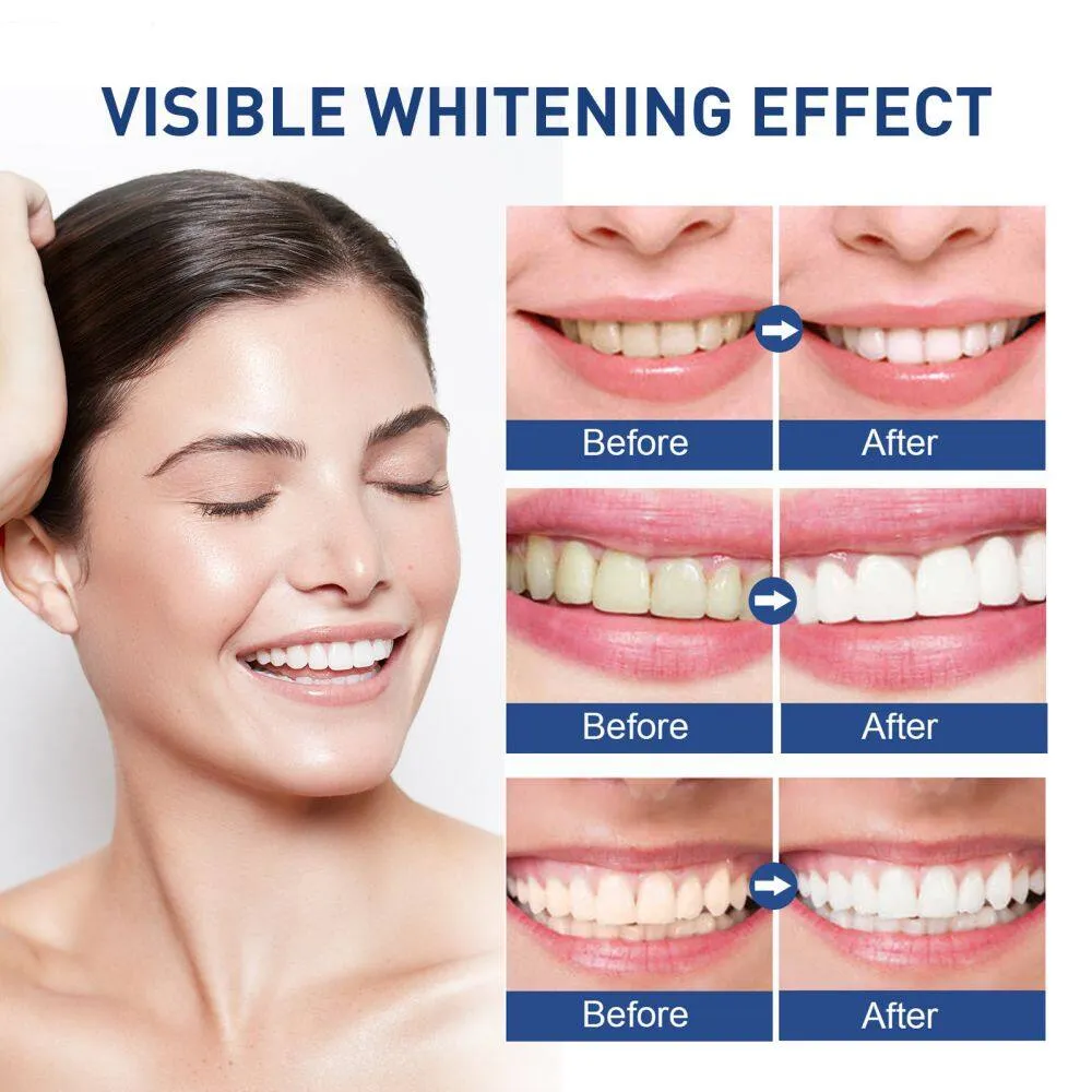 ayuting Teeth Whitening Paint Remove Plaque Stain Yellow Teeth Stain Sensitive Mouth Breath  Oral Care 5ml