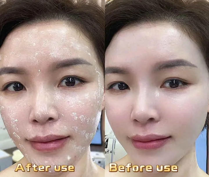 Danxuenilan Whitening Freckle Removal-كريم دانكسوينيلان