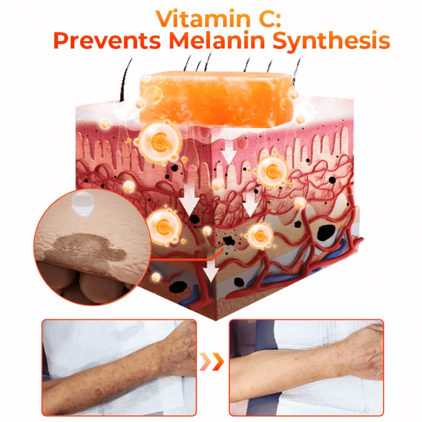 Flysmus KojiWhite Kojic Acid Dark Spot Corrector Soap