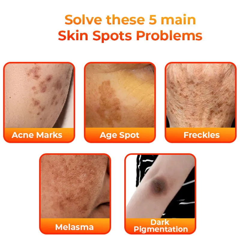 Flysmus KojiWhite Kojic Acid Dark Spot Corrector Soap