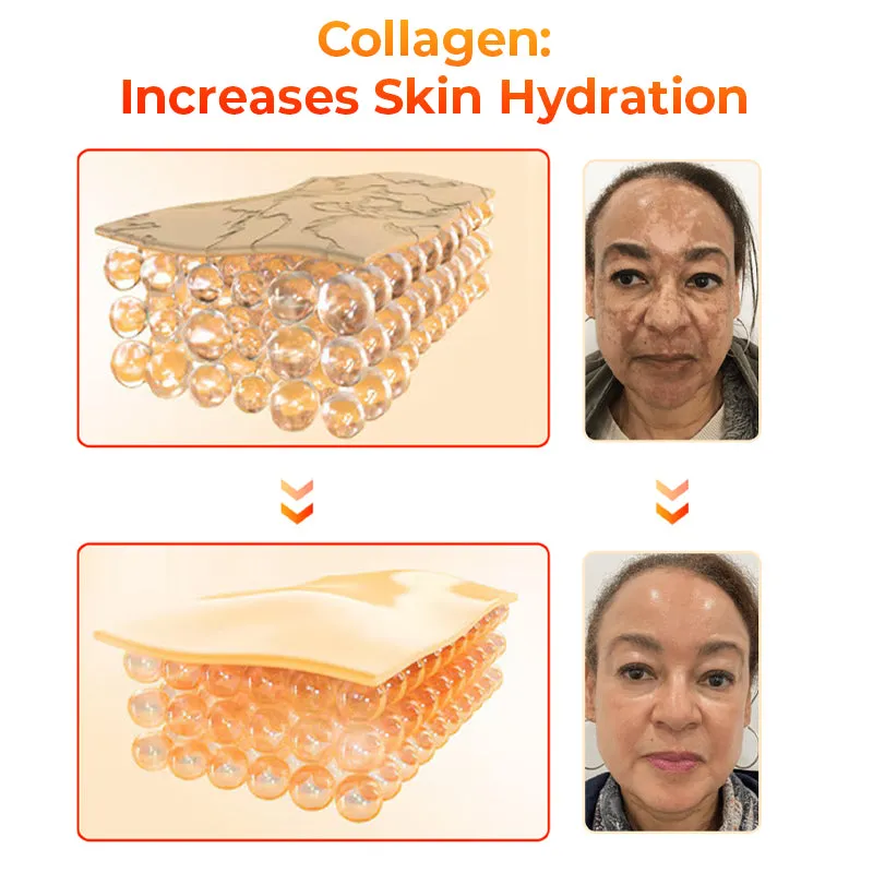 Flysmus KojiWhite Kojic Acid Dark Spot Corrector Soap