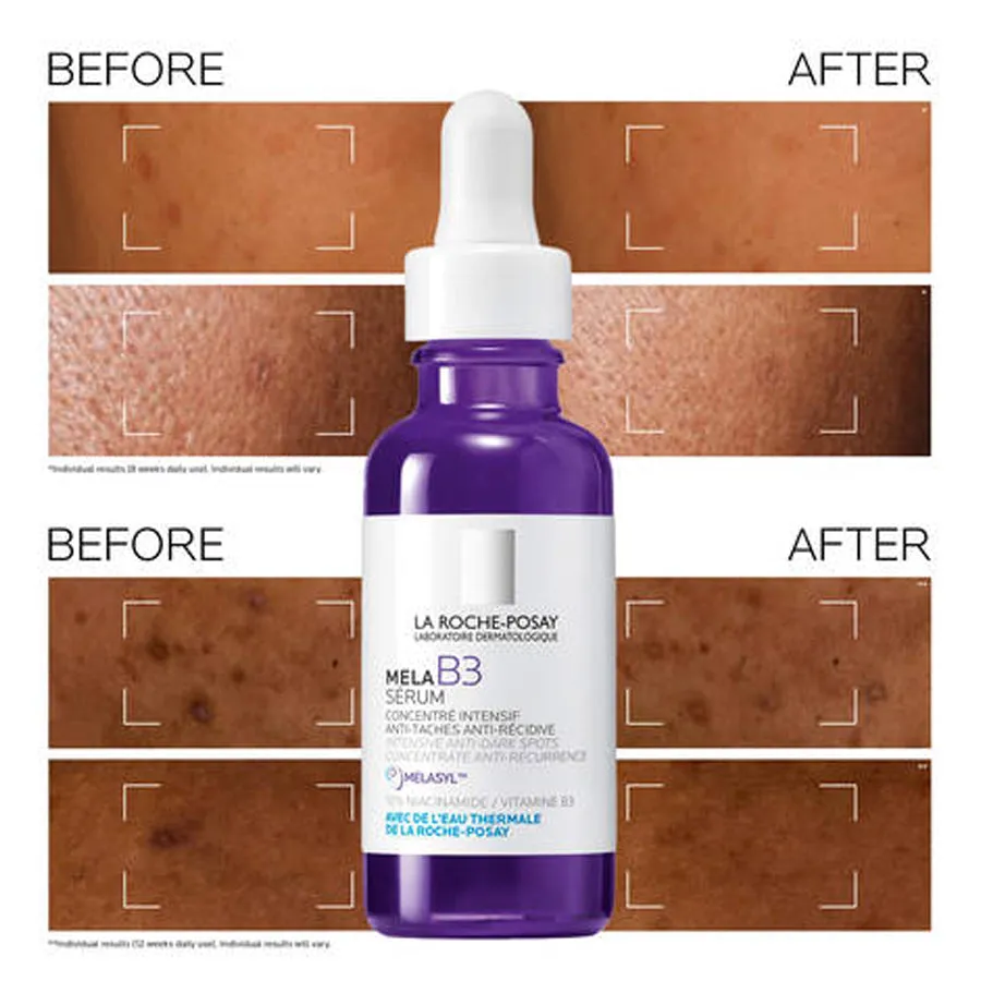 La Roche-Posay Mela B3 Intense Anti-Dark Spot Serum 30ml